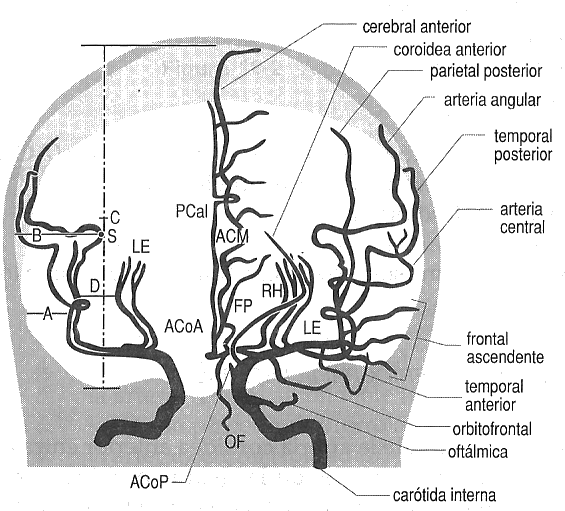 angiografia_cerebral [Neurocirugía Contemporánea]