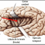 operculofrontal.png